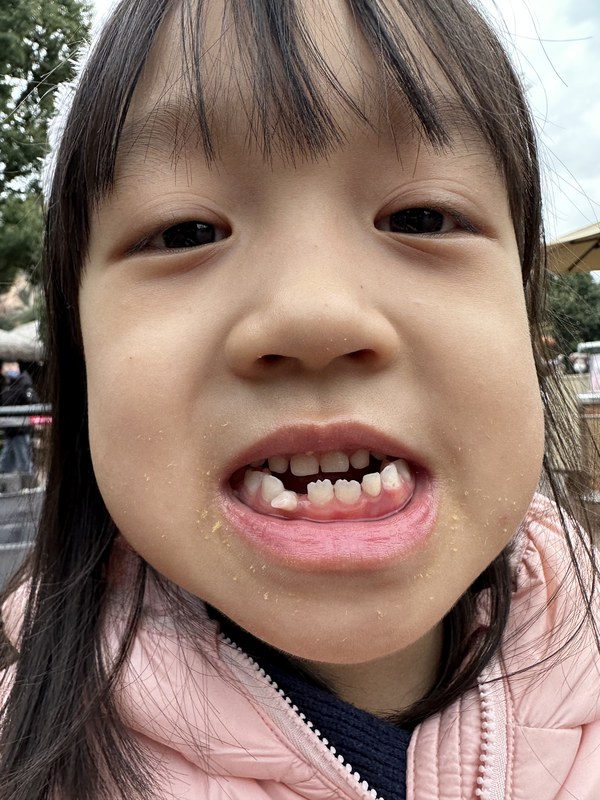 掉了两颗牙